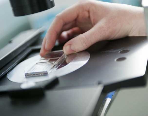 SAMe或成慢性结肠炎新希望？